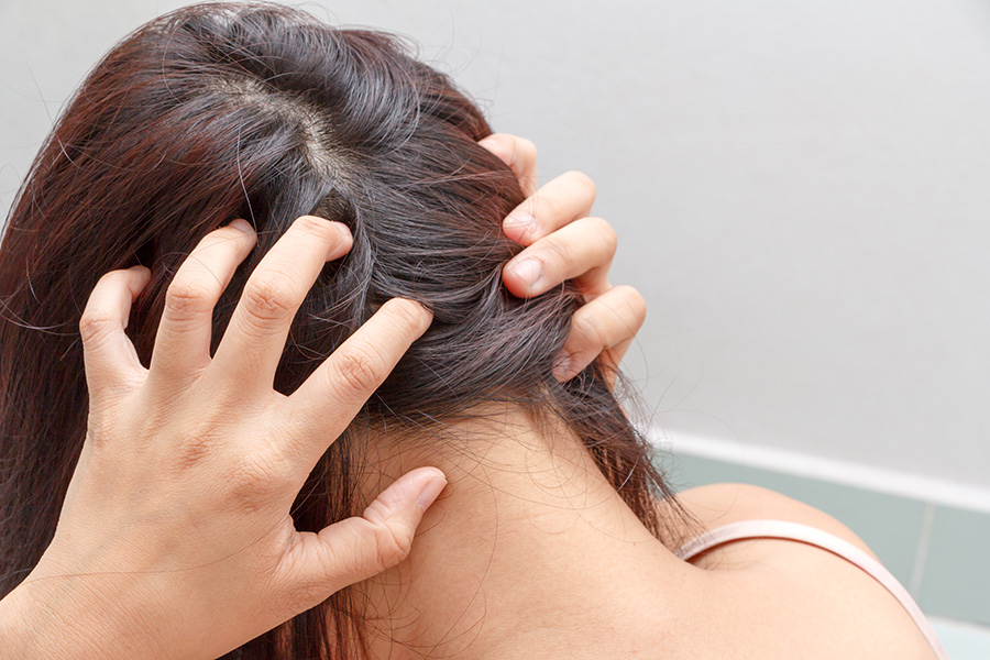 Here's Why You Have an Itchy Scalp | HealthScoopTwitterFacebookWhatsAppEmailTwitterFacebookWhatsAppEmail Here's Why You Have an Itchy Scalp | HealthScoopTwitterFacebookWhatsAppEmailTwitterFacebookWhatsAppEmail